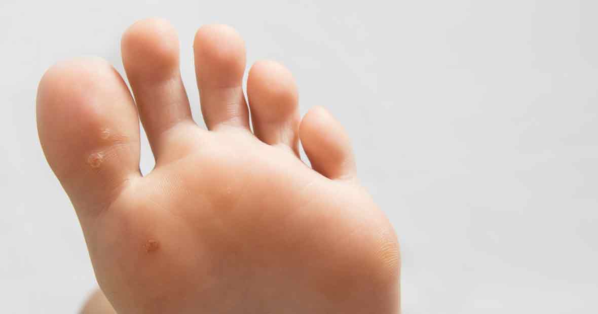 cors au pied